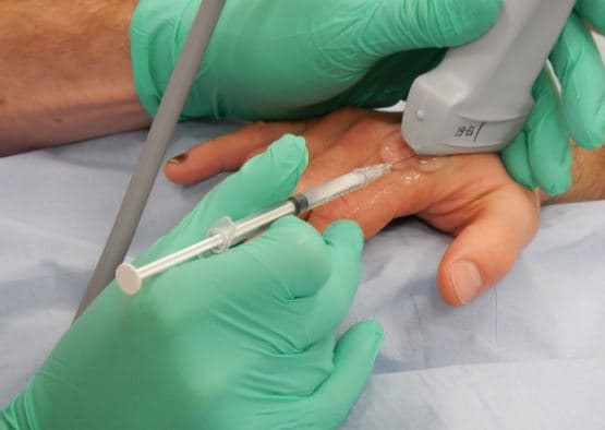 حقن الكورتيزون| الستيرويدات