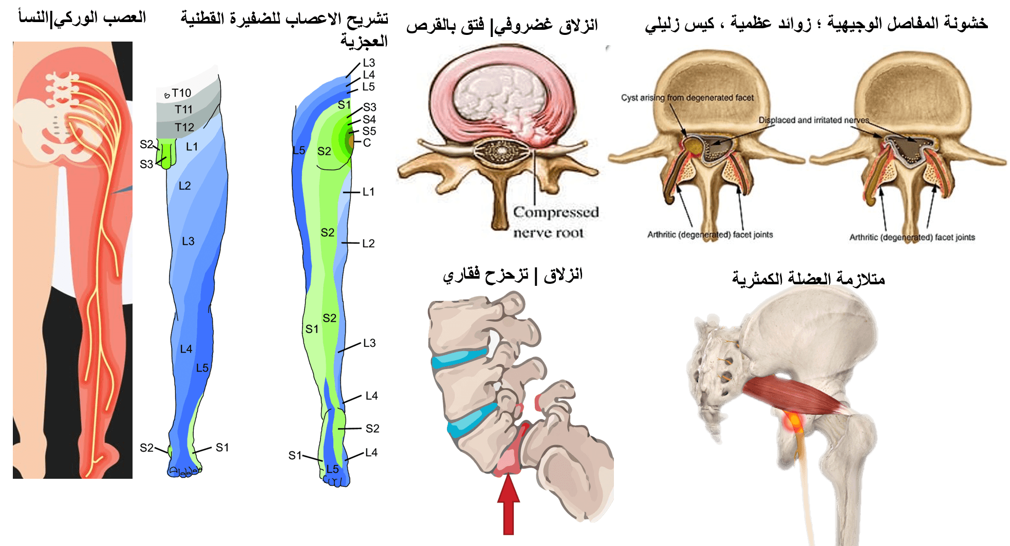 عرق النسأ|العصب الوركي